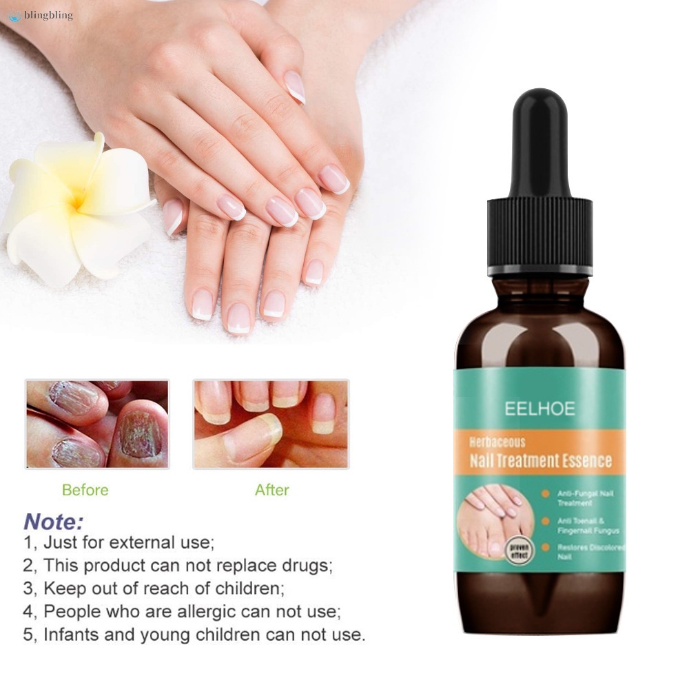 Tinh Chất Hỗ Trợ Giảm Bệnh Nấm Móng Tay Móng Chân Dung Tích 10ml 30ml