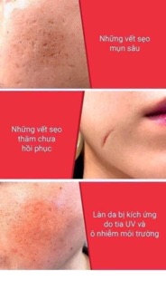 Sữa rửa mặt Some By Mi