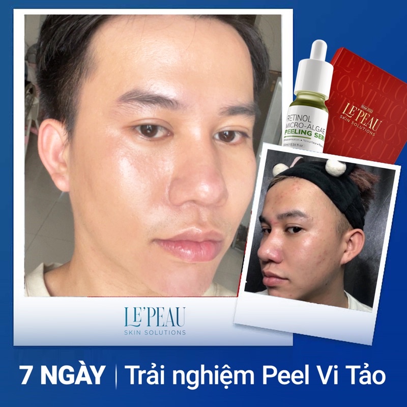Peel da vi tảo retinol Le Peau 10ml, serum tái tạo da sinh học, Tặng B5 - LEPEAU VIETNAM