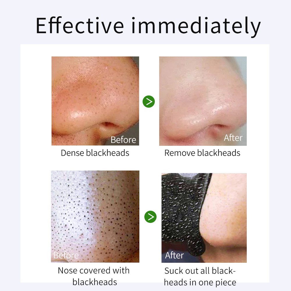 Mặt Nạ Mũi Làm Sạch Sâu Loại Bỏ Mụn Đầu Đen Bằng Than Tre Tự Nhiên | BigBuy360 - bigbuy360.vn