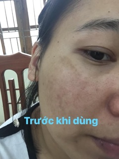 Bột thảo mộc trắng da thầy Lang Hùng