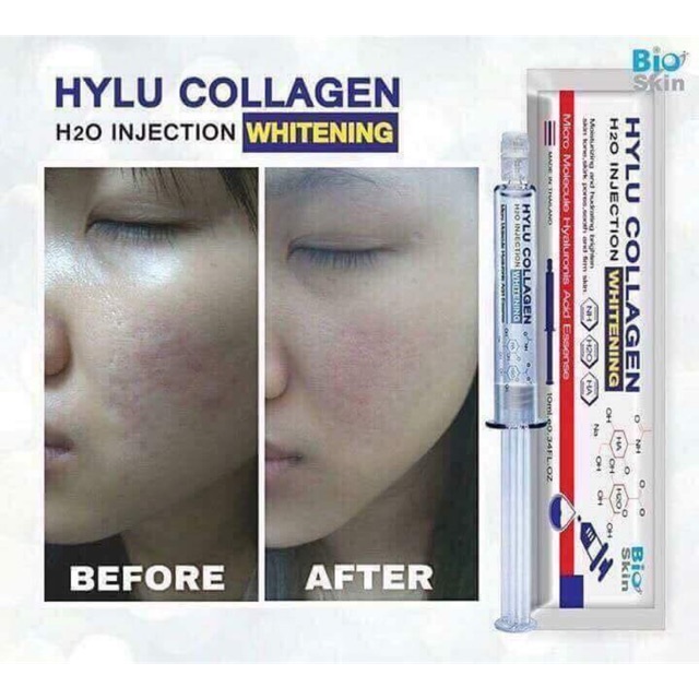  Tuýp collagen Hylu ( sale )