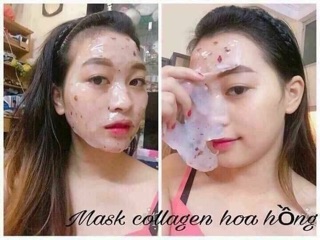 MASK COLLAGEN HOA HỒNG 