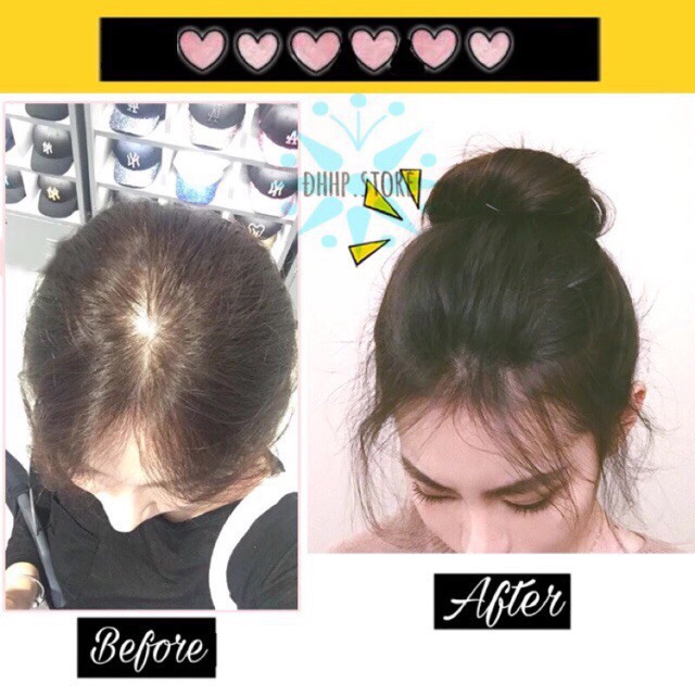 Tóc giả che hói bấm phồng sẵn ❤️FREESHIP❤️ Tóc giả kẹp phồng che hói mái tóc