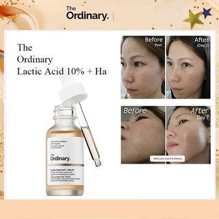 Serum Lactic Acid + HA The Ordinary
