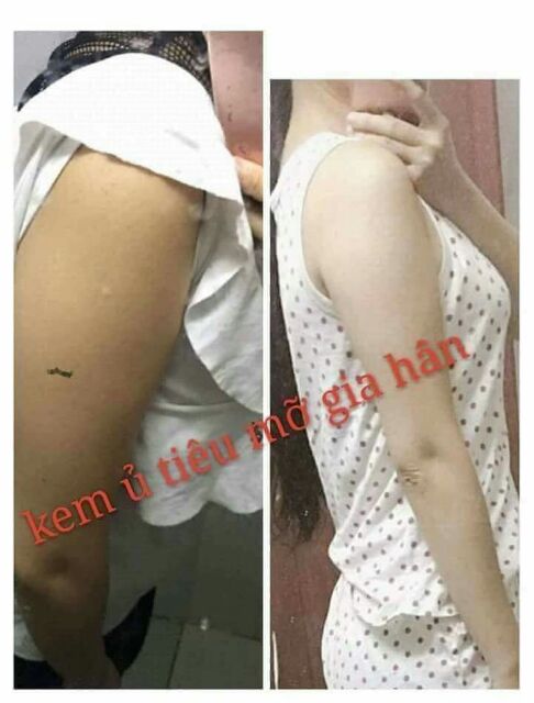 Kem ủ tiêu mỡ Gia Hân