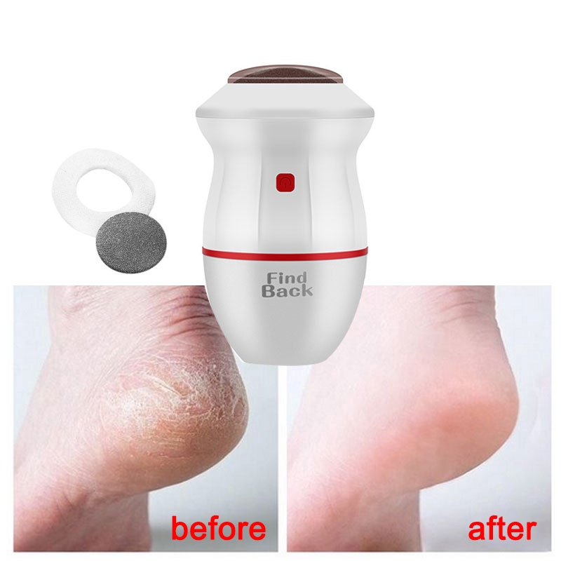 [Hàng mới về] Máy loại bỏ vết chai sần gót chân có cổng usb tiện dụng