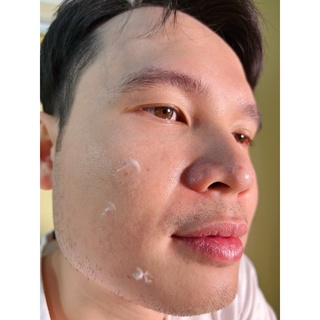 Kem chấm giảm mụn KOSXU