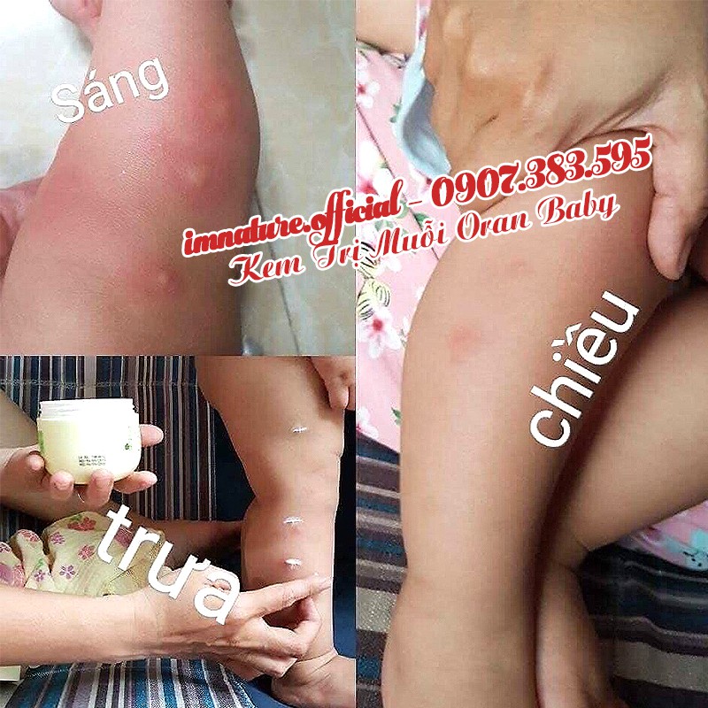 Cao Tinh Dầu Tràm Cung Đình Huế Dùng Được Cho Trẻ Sơ Sinh