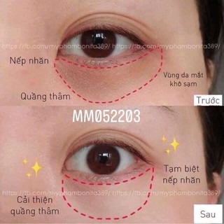 Hộp 60 miếng) mặt nạ mắt bioaqua