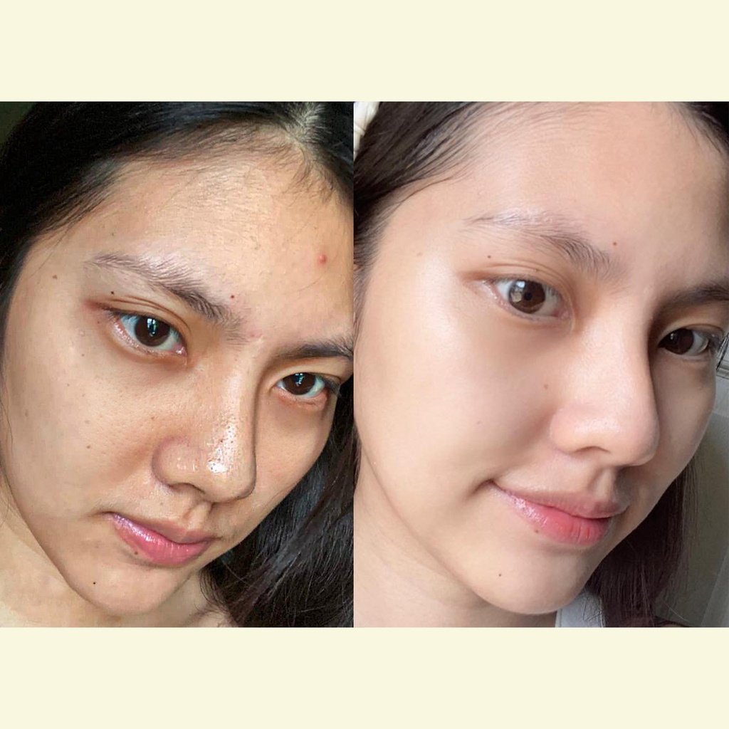 Combo sản phẩm dưỡng trắng và cấp ẩm cho da OMUSE Oh So Glowy Brightening