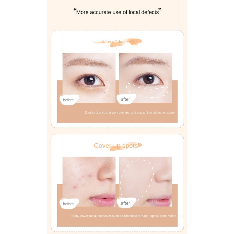 (Hàng Mới Về) Kem Che Khuyết Điểm Agag Hai Đầu Che Phủ Mụn Và Quầng Thâm Mắt Hiệu Quả | BigBuy360 - bigbuy360.vn