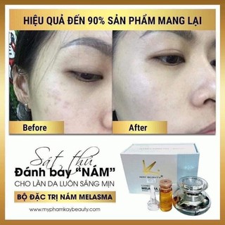 Combo Nám kay beauty (diễn viên NGÂN QUỲNH sử dụng)