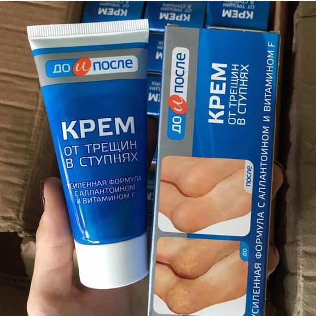 Kem giảm nứt gót chân Kpem Apteka Nga 50ml giữ ẩm cho da, làm mềm da chân