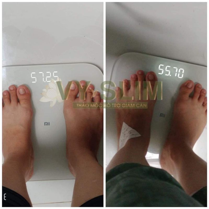 Giảm mỡ bụng V.Y S. L.I.M chĩnh hãng