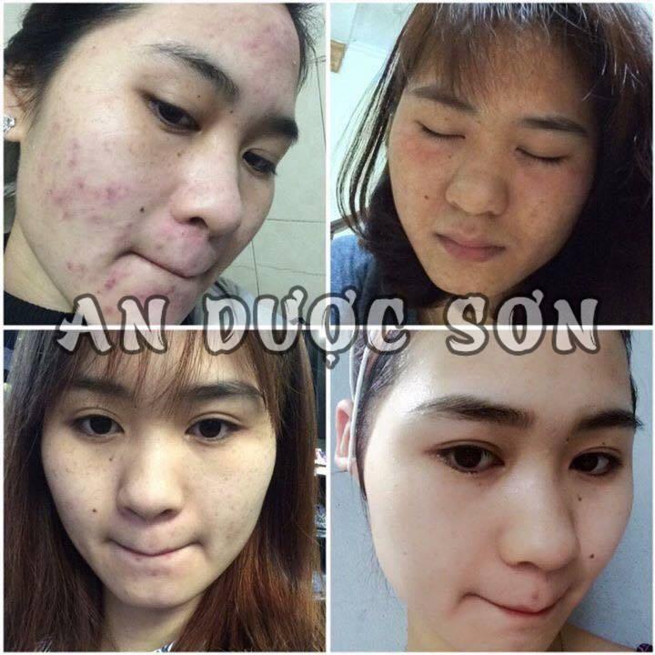 Serum An Dược Sơn 30ml - Serum Tái Tạo Da An Dược Sơn