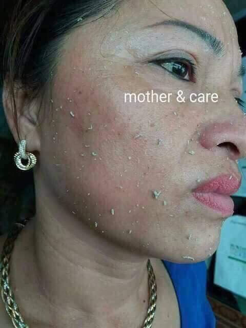 tẩy da chết mother and care