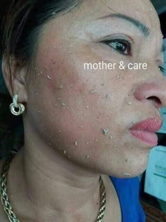 tẩy da chết mother and care