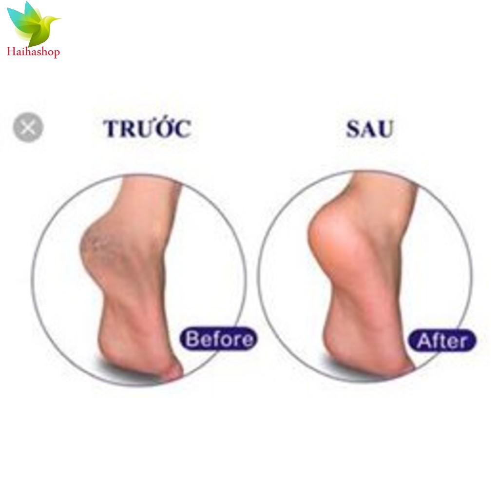 [SP Chính Hãng] Kem trị nứt gót chân BA Thái Lan