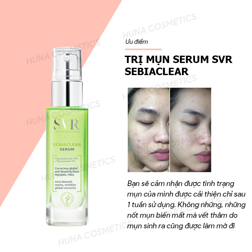 Tinh Chất Dưỡng Chất Kiềm Dầu và Giảm Mụn Mờ Thâm SVR Sebiaclear Serum 30ml