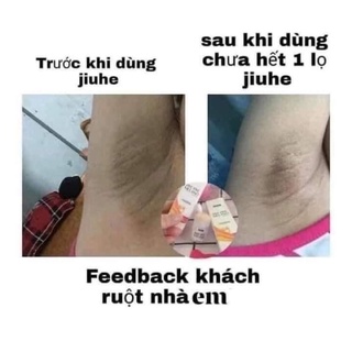 Giảm Thâm Jiuhe Bye Bye Melano