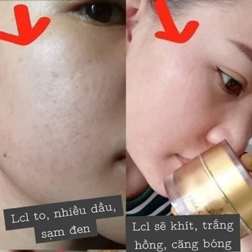 [CAM KẾT CHÍNH HÃNG] Kem Face Collagen X3 ngừa mụn, hết thâm nám, Mỹ Phẩm Đông Anh