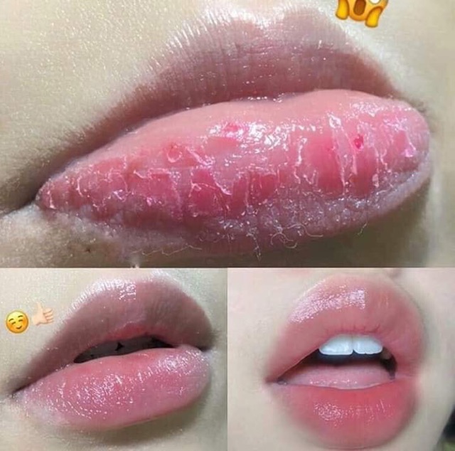 Mặt nạ ủ môi Laneige