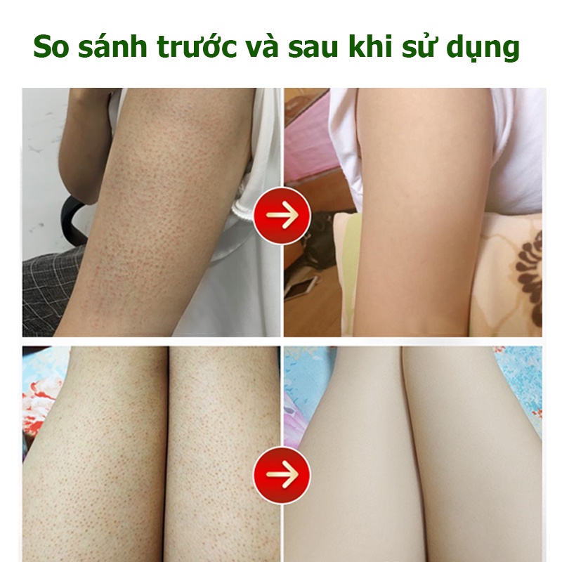 Tẩy tế bào chết chiết xuất tinh chất từ quả đào,Tẩy tế bào chết toàn thân, Tẩy Tế Bào Chết Mặt，làm trắng da toàn thân