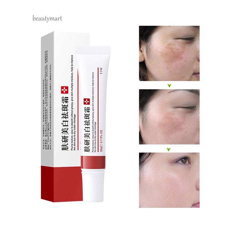 [Hàng mới về] Kem Dưỡng Trắng Da Mặt Chống Mụn Và Làm Sáng Da Nhanh Chóng Cho Nữ