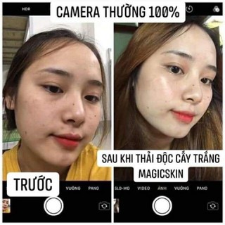 Ủ Yến Thải Độc
