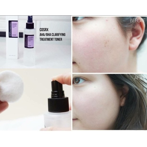 Nước Cân Bằng Tẩy Tế Bào Chết Hoá Học COSRX AHA/BHA Clarifying Treatment Toner 100ml, 150ml