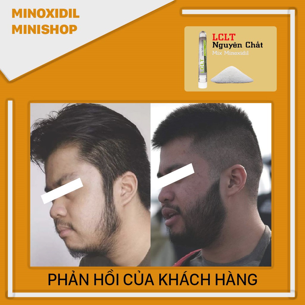 LCLT Hỗ Trợ Kích Thích Mọc Râu Tóc