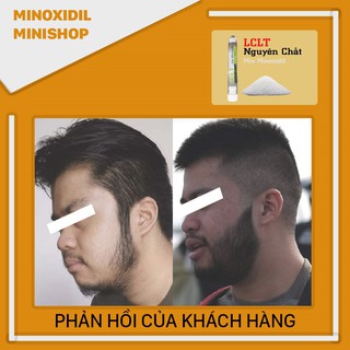 LCLT Hỗ Trợ Kích Thích Mọc Râu Tóc (Pha vào Mino Lỏng)