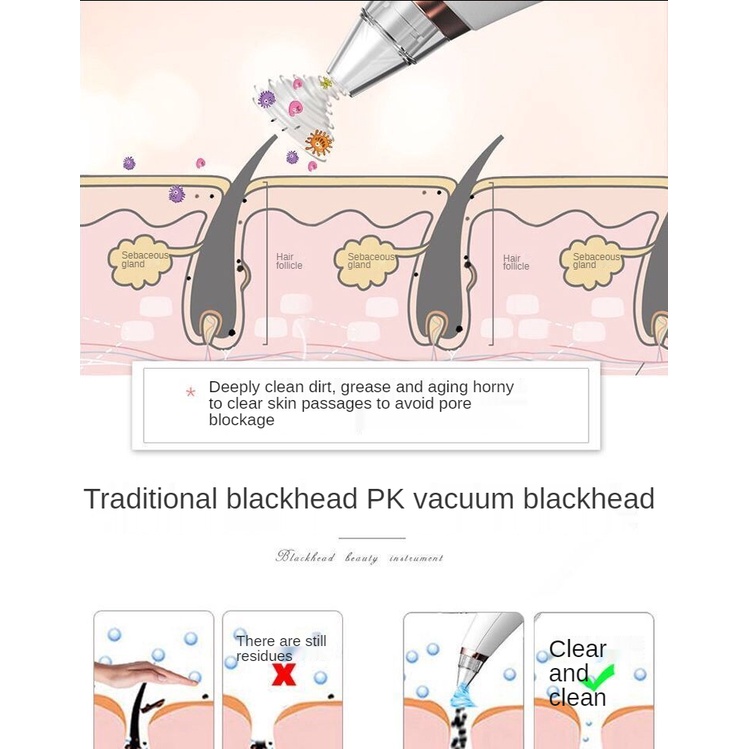 Loại bỏ mụn đầu đen, thiết bị làm sạch da mặt, bong bóng điện nhỏ để đóng lỗ chân lông