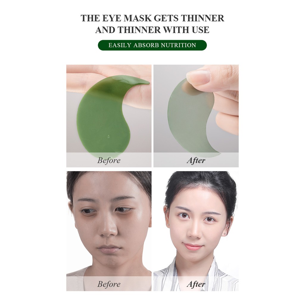Set 30 cặp mặt nạ mắt rong biển Fenyi làm săn chắc da loại bỏ quầng thâm và bọng mắt
