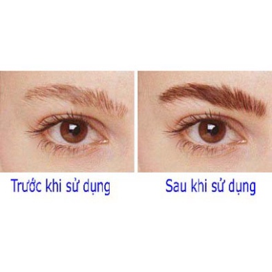 Dưỡng Chân Mày Eveline 8B1 Total Action Eyebrow Therapy 10ml