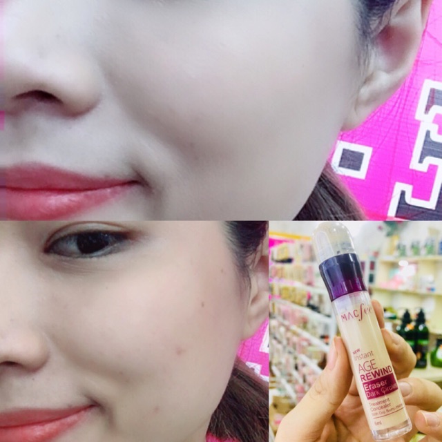 Kem che khuyết điểm MACfee