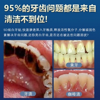 [Hàng mới về] Miếng dán làm trắng răng tiện lợi