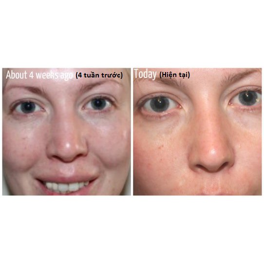 Kem dưỡng mắt sáng da Superdrug Naturally Radiant Brightening Eye Cream 15ml | BigBuy360 - bigbuy360.vn