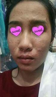 Thảo dược Đông y Sắc Mộc Lan
