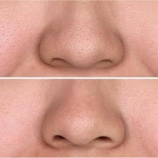 (Mã NSF020280 giảm 80K) Tinh Chất Cosrx Two In One Poreless Power Liquid