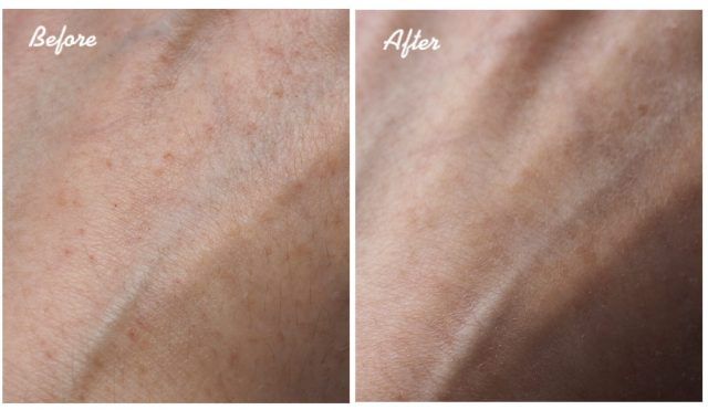 Bill Canada Niod serum phục hồi da Modulating Glucosides