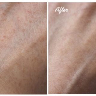 bill Canada Niod MG serum phục hồi da Modulating Glucosides