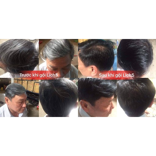 Dầu Gội Thảo Dược Đen Tóc- LICH5, Gội Là Đen, Cocayhoala | BigBuy360 - bigbuy360.vn