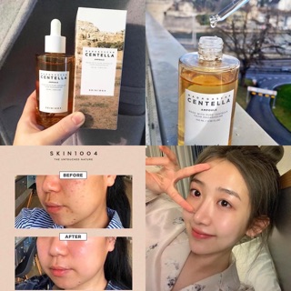  SERUM RAU MÁ PHỤC HỒI DA NHẠY CẢM CENTELLA AMPOULE