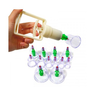 Dụng Cụ Giác Hơi 12 Món Không Cần Lửa