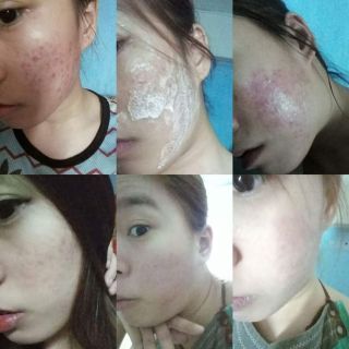 Thảo dược tái tạo da