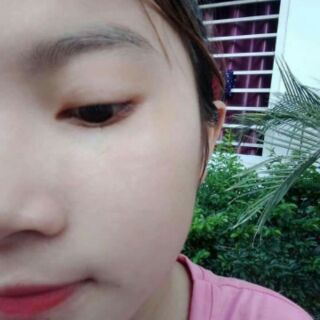 chấm tàn nhang phương anh