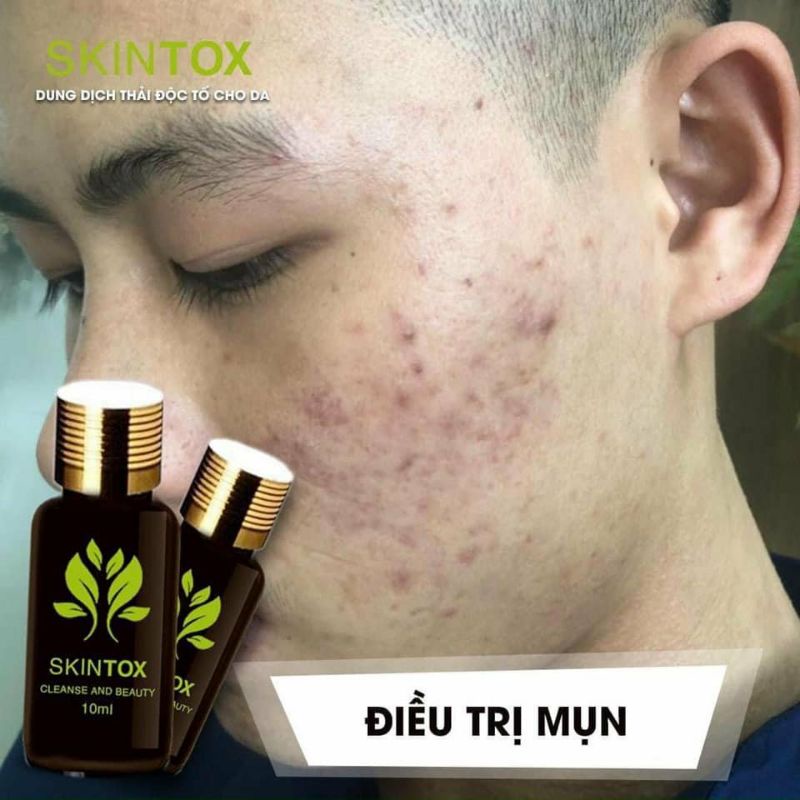 Serum đào thải nám  tàn nhang mụn Skintox Dimanlaier