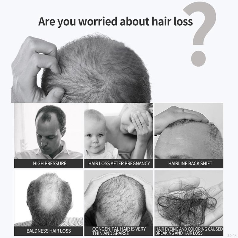 Dầu mọc tóc PURC chống gẫy rụng cao cấp tiện dụng | BigBuy360 - bigbuy360.vn